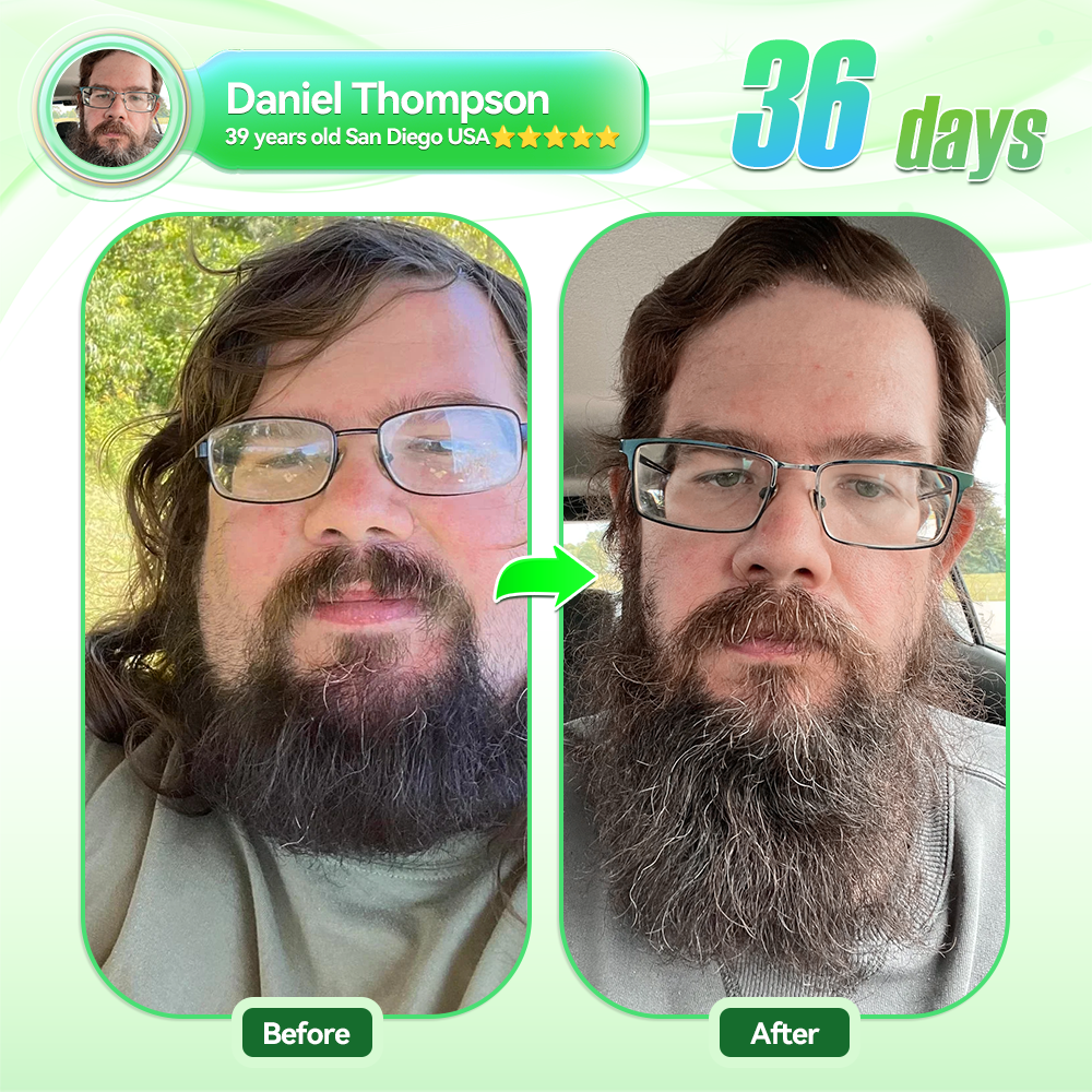 ๐บ๐ธ๐ถ๐๐๐๐๐๐๐ ๐บ๐๐๐๐|๐ฉโโ๏ธ๐ฉโโ๏ธHH๐๐ยฎ ๐๐๐+ ๐๐๐-๐ Pro ALL-IN-ONE Fit&Vital ๐๐ซ๐๐ฅ ๐๐ข๐ช๐ฎ๐ข๐ (๐๐ฎ๐ฌ๐ญ ๐จ๐ง๐๐ ๐ ๐๐๐ฒ, ๐ฏ๐ข๐ฌ๐ข๐๐ฅ๐ ๐๐ก๐๐ง๐ ๐๐ฌ ๐ข๐ง ๐ ๐๐๐ฒ๐ฌ๏ผ โ
๐
๐จ๐ซ ๐จ๐๐๐ฌ๐ข๐ญ๐ฒ, ๐๐๐ซ๐๐ข๐จ๐ฏ๐๐ฌ๐๐ฎ๐ฅ๐๐ซ ๐ก๐๐๐ฅ๐ญ๐ก, ๐๐ข๐๐๐๐ญ๐๐ฌ, ๐ฌ๐ฅ๐๐๐ฉ ๐๐ฉ๐ง๐๐, ๐๐ฎ๐ญ ๐๐๐๐ฅ๐ญ๐ก, ๐ฃ๐จ๐ข๐ง๐ญ ๐ข๐ฌ๐ฌ๐ฎ๐๐ฌ, ๐๐ง๐ ๐ฆ๐จ๐ซ๐