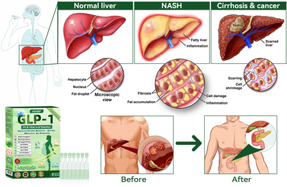 (HHVB®) 🔥 Only 6 boxes left! Get 30% off today! The GLP-1 oral solution helps manage weight and blood sugar, with lasting results in 4–6 boxes. Don’t wait—act fast!